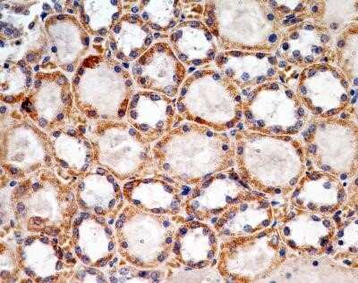 Immunohistochemistry: SOX2 Antibody (4G8) - Azide and BSA Free [NBP2-80957]