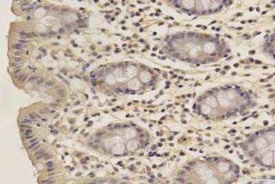 Immunohistochemistry-Paraffin: SOX2 Antibody (4G8) - Azide and BSA Free [NBP2-80957]