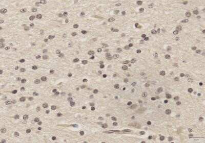 Immunohistochemistry-Paraffin: SOX2 Antibody (4G8) - Azide and BSA Free [NBP2-80957]