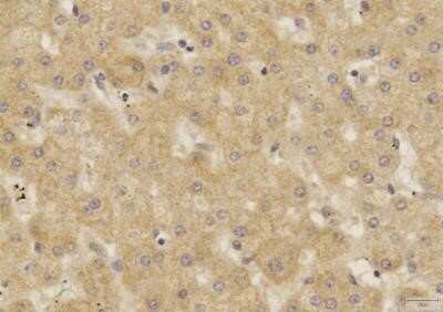 Immunohistochemistry-Paraffin: SOX2 Antibody (4G8) - Azide and BSA Free [NBP2-80957]