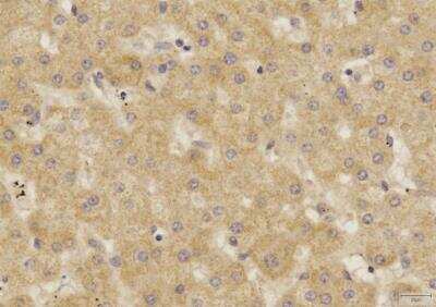 Immunohistochemistry-Paraffin: SOX2 Antibody (4G8) - BSA Free [NBP2-29623]