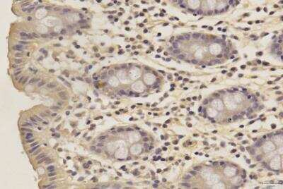 Immunohistochemistry-Paraffin: SOX2 Antibody (4G8) - BSA Free [NBP2-29623]