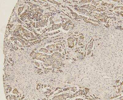 Immunohistochemistry-Paraffin: SOX2 Antibody (4G8) - BSA Free [NBP2-29623]