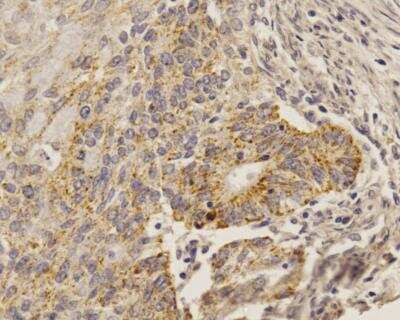 Immunohistochemistry-Paraffin: SOX2 Antibody (4G8) - BSA Free [NBP2-29623]