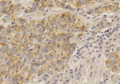Immunohistochemistry-Paraffin: SOX2 Antibody (4G8) - BSA Free [NBP2-29623]