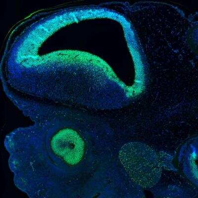Immunohistochemistry: SOX2 Antibody (CL4716) [NBP2-59057]