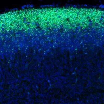 Immunohistochemistry: SOX2 Antibody (CL4716) [NBP2-59057]