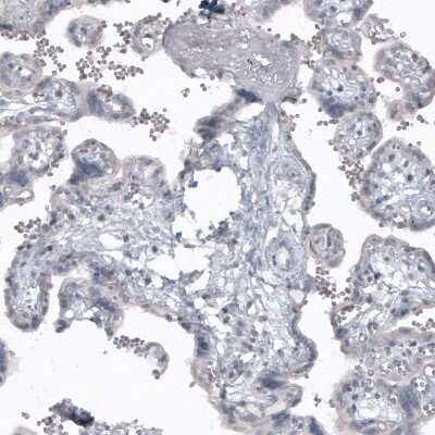 Immunohistochemistry-Paraffin: SOX2 Antibody (CL4716) [NBP2-59057]