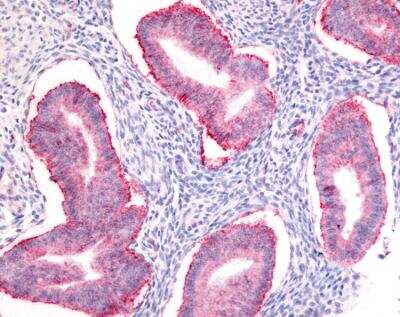 Immunohistochemistry-Paraffin: SOX2 Antibody - BSA Free [NB110-37235]