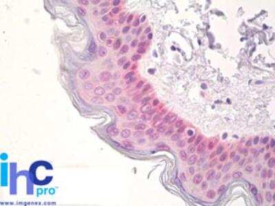 Immunohistochemistry-Paraffin: SOX2 Antibody [NBP2-24390]