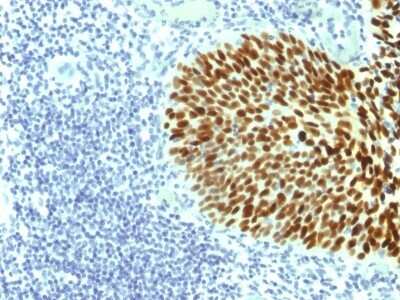 Immunohistochemistry-Paraffin: SOX2 Antibody (SOX2/1791) - Azide and BSA Free [NBP2-54594]
