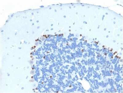 Immunohistochemistry-Paraffin: SOX2 Antibody (SOX2/1791) - Azide and BSA Free [NBP2-54594]