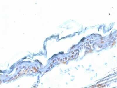 Immunohistochemistry-Paraffin: SOX2 Antibody (SOX2/1791) [NBP2-53407]