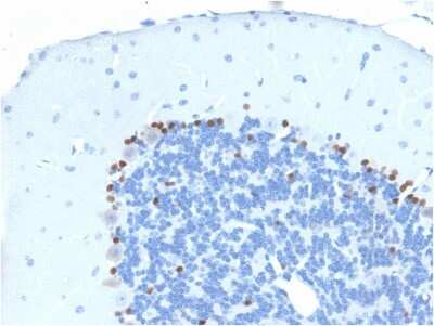 Immunohistochemistry-Paraffin: SOX2 Antibody (SOX2/1791) [NBP2-53407]