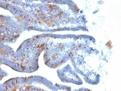 Immunohistochemistry-Paraffin: SOX2 Antibody (SOX2/1792) - Azide and BSA Free [NBP2-54593]