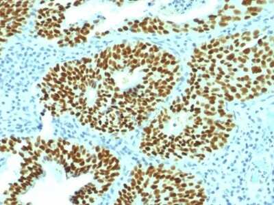 Immunohistochemistry-Paraffin: SOX2 Antibody (SOX2/1792) [NBP2-53408]