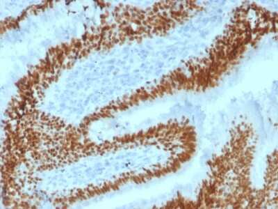 Immunohistochemistry-Paraffin: SOX2 Antibody (SOX2/1792) [NBP2-53408]