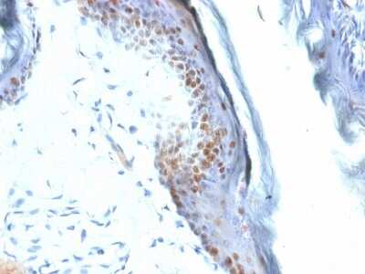 Immunohistochemistry-Paraffin: SOX2 Antibody (SOX2/1792) [NBP2-53408]