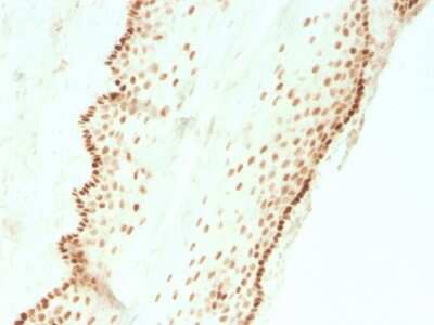 Immunohistochemistry-Paraffin: SOX2 Antibody (SOX2/3811R) - Azide and BSA Free [NBP3-08524]