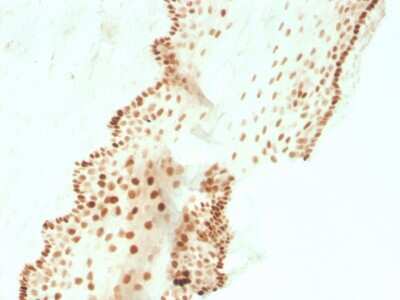 Immunohistochemistry-Paraffin: SOX2 Antibody (SOX2/3811R) - Azide and BSA Free [NBP3-08524]