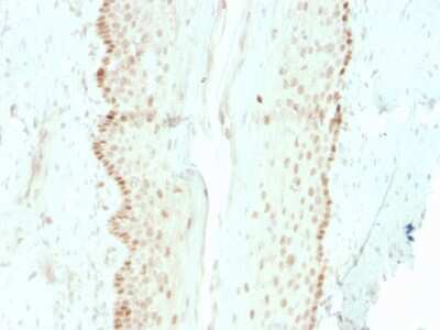 Immunohistochemistry-Paraffin: SOX2 Antibody (rSOX2/1792) - Azide and BSA Free [NBP3-08503]