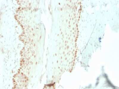 Immunohistochemistry-Paraffin: SOX2 Antibody (rSOX2/1792) - Azide and BSA Free [NBP3-08503]
