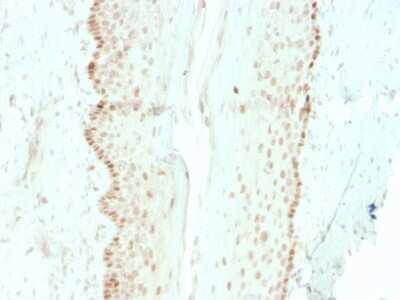 Immunohistochemistry-Paraffin: SOX2 Antibody (rSOX2/1792) [NBP3-07888]