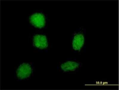 Immunocytochemistry/ Immunofluorescence: SOX21 Antibody (2G10) [H00011166-M01]