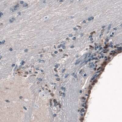 Immunohistochemistry-Paraffin: SOX21 Antibody (CL4681) [NBP2-59058]