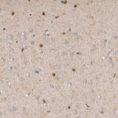 Immunohistochemistry-Paraffin: SOX21 Antibody (CL4681) [NBP2-59058]