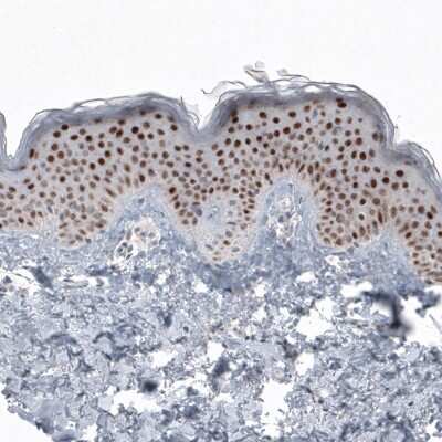 Immunohistochemistry-Paraffin: SOX21 Antibody (CL4681) [NBP2-59058]
