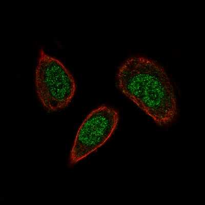 Immunocytochemistry/ Immunofluorescence: SOX21 Antibody (CL4688) [NBP2-59059]
