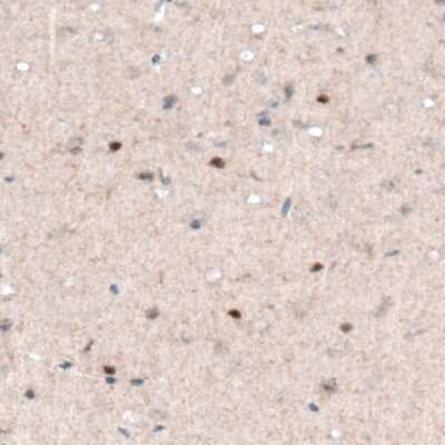 Immunohistochemistry-Paraffin: SOX21 Antibody (CL4688) [NBP2-59059]