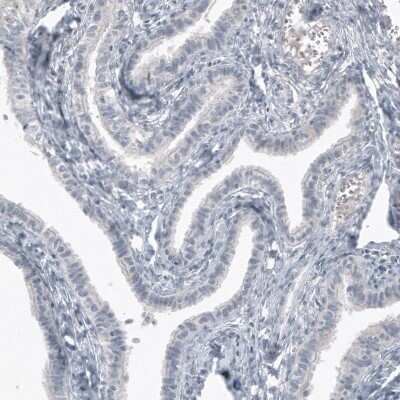 Immunohistochemistry-Paraffin: SOX21 Antibody (CL4688) [NBP2-59059]