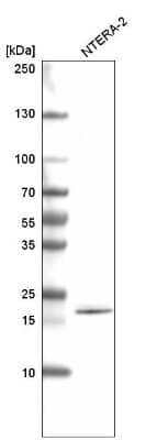 Western Blot: SOX21 Antibody (CL4688) [NBP2-59059]