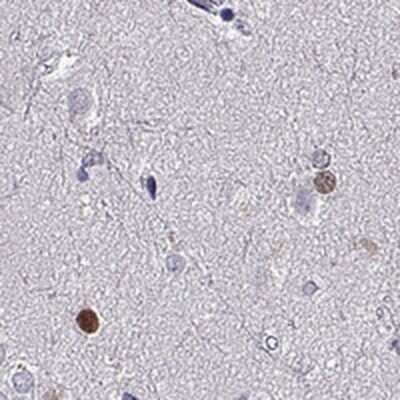 Immunohistochemistry: SOX21 Antibody [NBP2-68682]