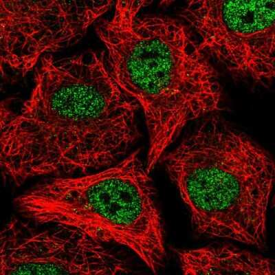 Immunocytochemistry/ Immunofluorescence: SOX22 Antibody [NBP2-55322]