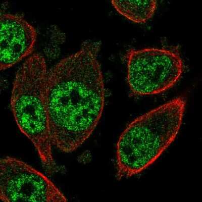 Immunocytochemistry/ Immunofluorescence: SOX22 Antibody [NBP2-56628]