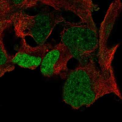 Immunocytochemistry/ Immunofluorescence: SOX3 Antibody [NBP2-55569]