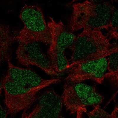 Immunocytochemistry/ Immunofluorescence: SOX3 Antibody [NBP2-57856]