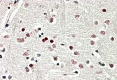 Immunohistochemistry-Paraffin: SOX3 Antibody [NBP1-52043]