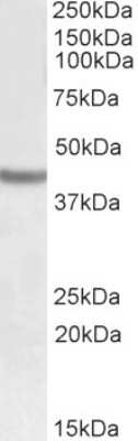 Western Blot: SOX3 Antibody [NBP1-52043]