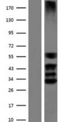 Western Blot: SOX3 Overexpression Lysate [NBP2-07720]