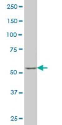 Western Blot: SOX30 Antibody (6H1) [H00011063-M02]