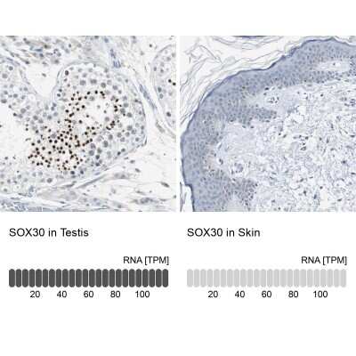 Immunohistochemistry-Paraffin: SOX30 Antibody [NBP1-86503]