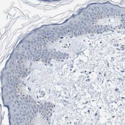 Immunohistochemistry-Paraffin: SOX30 Antibody [NBP1-86503]