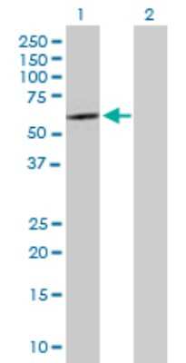 Western Blot: SOX30 Antibody [H00011063-B01P]