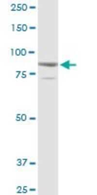 Western Blot: SOX30 Antibody [H00011063-D01P]