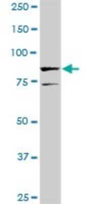 Western Blot: SOX30 Antibody [H00011063-D01P]