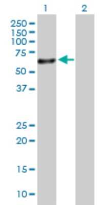 Western Blot: SOX30 Antibody [H00011063-D01P]